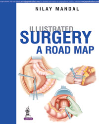 Illustrated Surgery A Road Map By Nilay Mandal