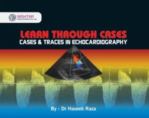 Learn Through Cases & Traces in Echocardiography By Dr Haseeb Raza