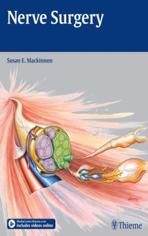 Nerve Surgery by Susan E Mackinnon
