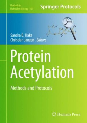 Protein Acetylation Methods and Protocols