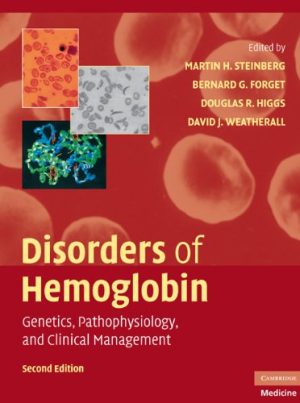 Disorders of Hemoglobin Genetics Pathophysiology and Clinical Management