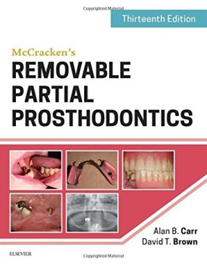 Mc Crackens Removable Partial Prosthodontics 13th Edition