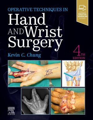 Operative Techniques Hand and Wrist Surgery 4th Edition