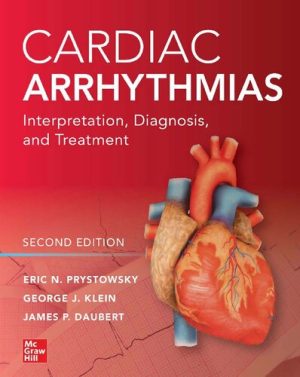 Cardiac Arrhythmias Interpretation Diagnosis and Treatment 2nd Ed