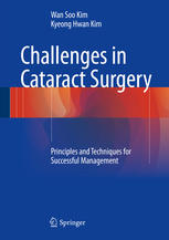 Challenges in Cataract Surgery Principles and Techniques for Successful Management