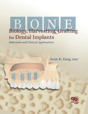 Bone Biology Harvesting and Grafting for Dental Implants Rationale and Clinical Applications