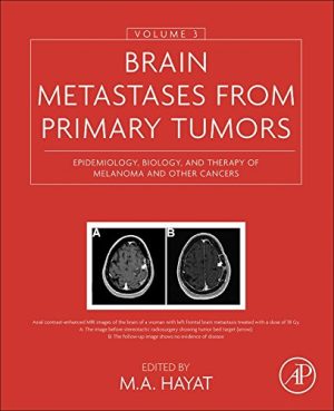 Brain Metastases from Primary Tumors Volume 3 Epidemiology Biology and Therapy of Melanoma and Other Cancers