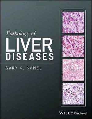 Pathology of liver diseases