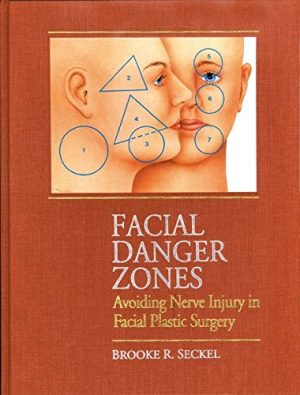 Facial Danger Zones Avoiding Nerve Injury in Facial Plastic Surgery 2nd Edition