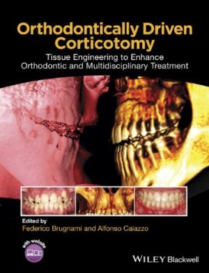 Orthodontically Driven Corticotomy Tissue Engineering to Enhance Orthodontic and Multidisciplinary Treatment