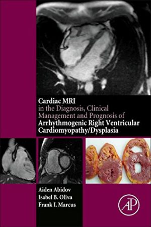 The Cardiac MRI in Diagnosis Clinical Management And Prognosis Of Arrhythmogenic Right Ventricular Cardiomyopathy Dysplasia