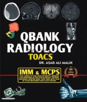 Qbank Radiology TOACS for IMM & MCPS By Dr Asad Ali Malik