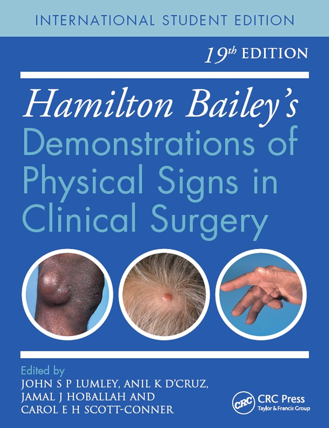 Hamilton Baileys Physical Signs Demonstrations of Physical Signs in Clinical Surgery 19th Edition