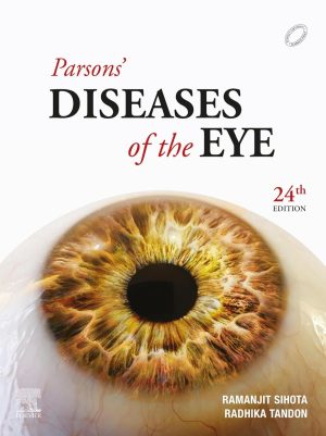 Parsons Diseases of the Eye 24th Edition